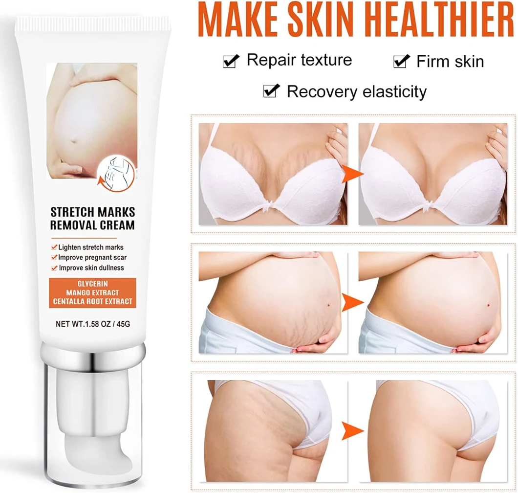 Aixin Beauty Cosmetics Pregnancy Skin Care Formula Massage Lotion for Stretch Marks Cream Deep Repair Acne Scar Removal Cream